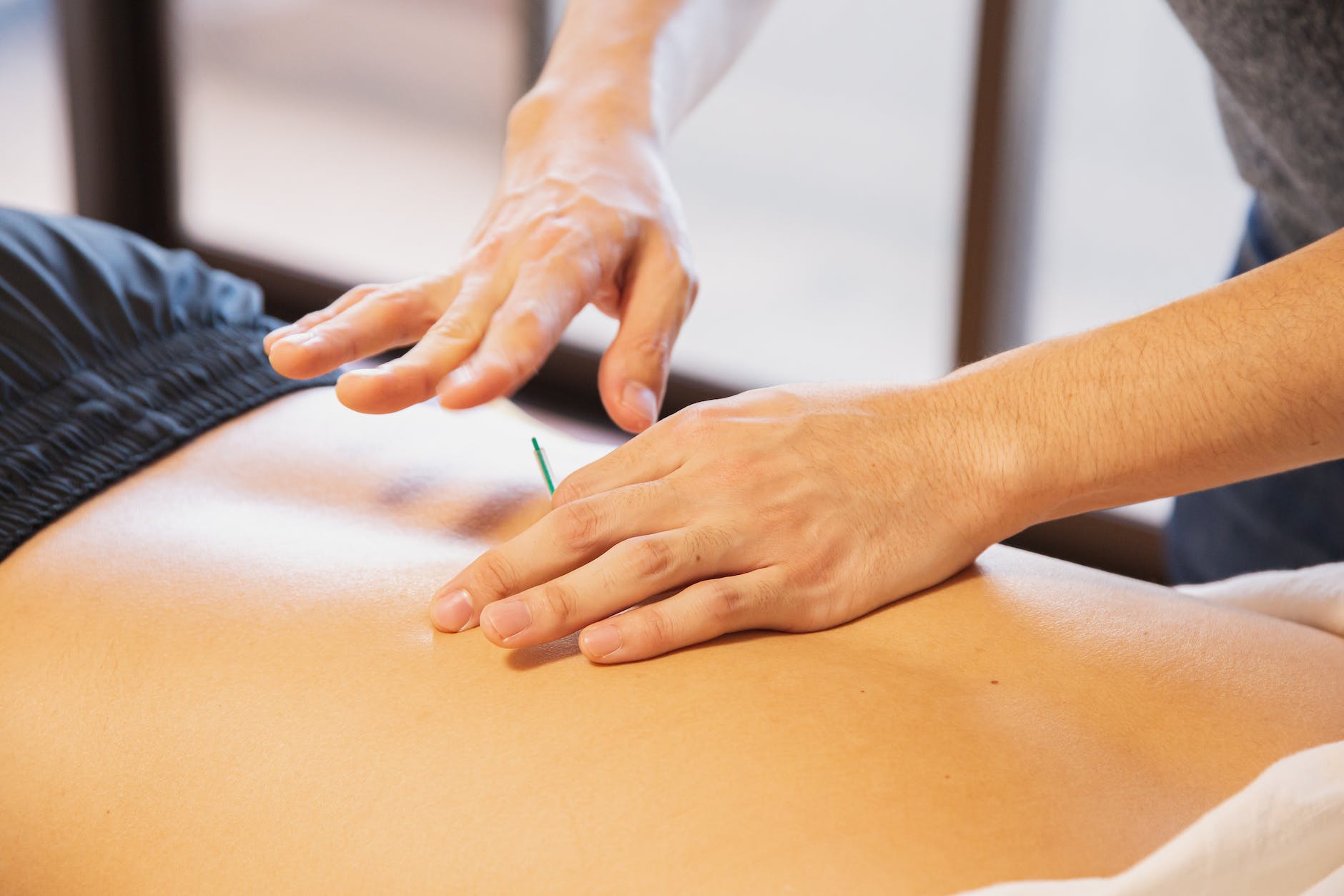 therapist inserting an acupuncture needle into a patients abdomen during a treatment.